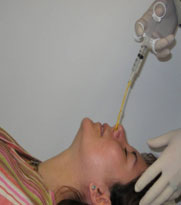 Foto que muestra la técnica correcta para obtener muestras nasofaríngeas para el aislamiento de la Bordetella pertussis.