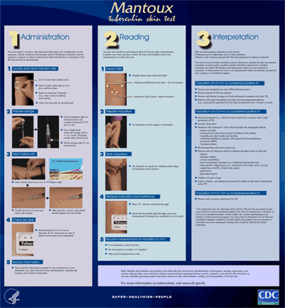 Image: Mantoux Tuberculin Skin Test Wall Chart