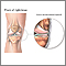 Ligamento medial colateral