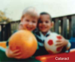 A photograph of two boys blurred to represent eyesight with Cataracts.