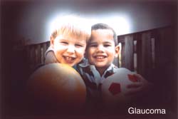 A photograph of two boys darkened around the edges to represent eyesight with Glaucoma