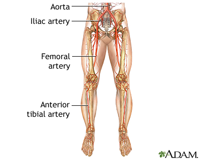 Normal anatomy