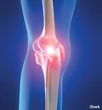 An illustration of a knee