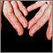 Amiloidosis en los dedos