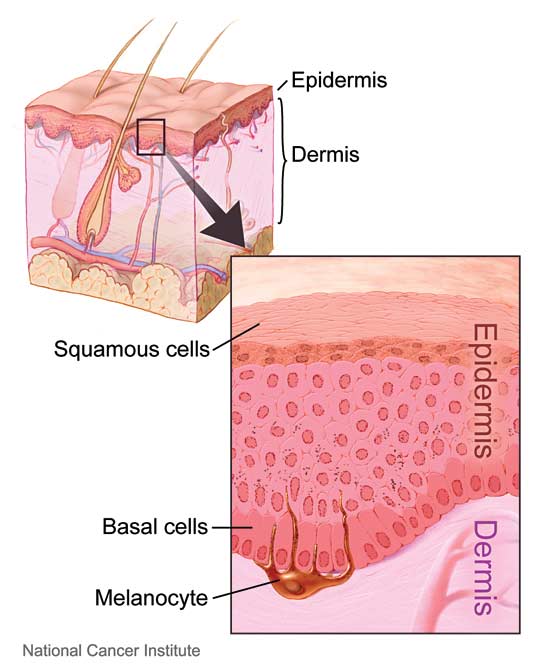 An NIH Illustration of the cross-section of human skin.