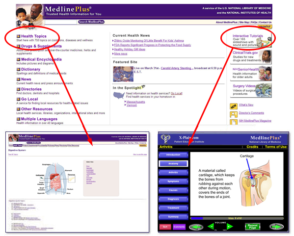 A screenshot of medlineplus homepage, a health topic and a interactive tutorial