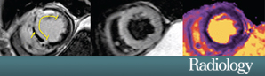 Radiology October 2012 Controversy: Croisille et al.