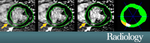 Radiology October 2012 Controversy: Arai et al