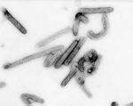 Isolate of Marburg virus with filamentous particles. Negative stain image.