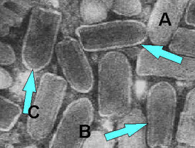 Electron microscope image of negatively stained Rhabdovirus