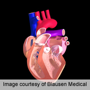 But small improvement detected in one measure of heart function, study found.
