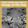Public Health Image Library Image of the Day (Tan)