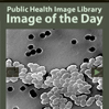 Public Health Image Library Image of the Day (Charcoal)