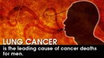 Lung Cancer: The Leading Cause of Cancer Deaths for Men