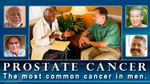 Prostate Cancer: The Most Common Cancer in Men