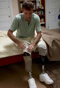 Photo: A man with prosthetic legs