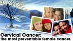 eCard: Cervical cancer