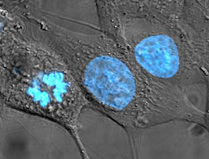 Células cancerosas HeLa teñidas de azul