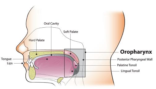 Diagram of the oral cavity and oropharynx. The oral cavity includes the lips, the labial and buccal mucosa, the front two-thirds of the tongue, the retromolar pad, the floor of the mouth, the gingiva, and the hard palate. The oropharynx includes the palatine and lingual tonsils, the back one-third (base) of the tongue, the soft palate, and the posterior pharyngeal wall.