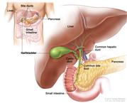 Anatomy of the gallbladder; shows the liver, common hepatic duct, cystic duct, common bile duct, pancreas, and small intestine. The inset shows the liver, bile ducts, gallbladder, pancreas, and small intestine.