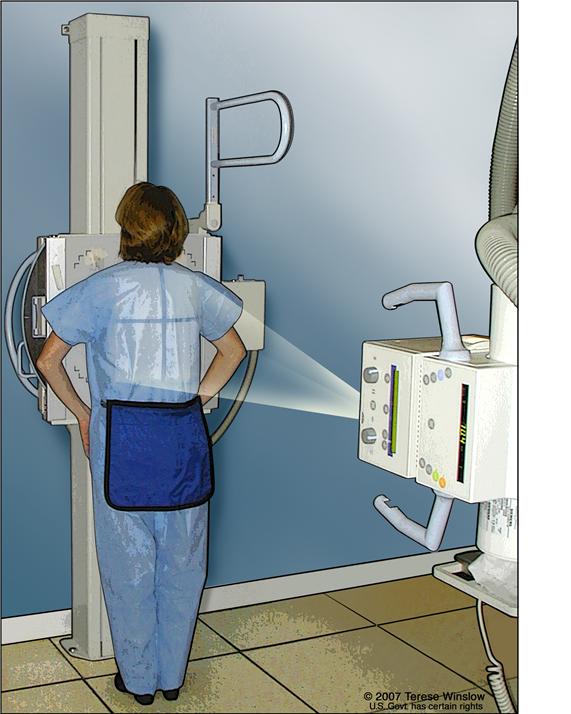 Radiografía del tórax; el dibujo muestra al paciente de pie con la espalda hacia la máquina de rayos-X. Las radiografías se utilizan para tomar fotografías de los órganos y huesos del tórax.  Las radiografías pasan a través del cuerpo y se plasman en una película.