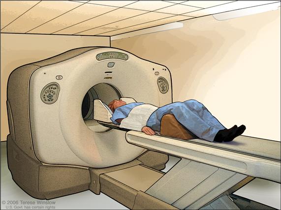 Exploración con TEP (tomografía por emisión de positrones); dibujo muestra al paciente acostado en una camilla que se desliza a través de una máquina de TEP.