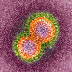 Colored transmission electron micrograph of H5N1 avian influenza virus particles.