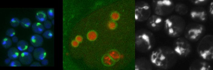 Images of cells with abnormal nuclear shape (from left): budding yeast carrying a mutation in the spo7 gene; C. elegans embryo in which lipin was downregulated; a mutant yeast strain that came out of a visual screen