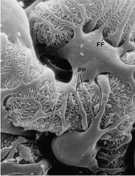The scanning electron micrograph shown below was taken from outside the capillary loop, so that the glomerular capillary appears as a tube which is entirely covered by podocyte primary processes and foot processes.