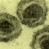 Transmission electron micrograph of round virus particles.