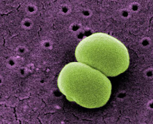 Scanning electron micrograph of 2 Staphylococcus epidermidis bacteria.