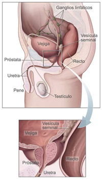 Gráfico: ilustración médica que muestra la ubicación de la próstata