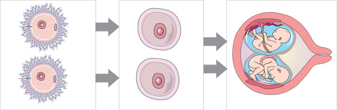 diagram of two, separate eggs are fertilized by two, separate sperm