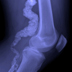 X-ray photo of a knee.