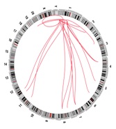 Translocations involving chromosome 1 in a set of colon and rectal samples. The locations of the breakpoints leading to the translocation and circular representations of all rearrangements in tumors with a fusion are shown.  The red line lines represent fusions, black lines indicate other rearrangements. 