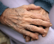 photo of arthritic hands