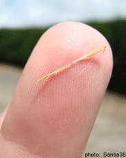 A photograph of a splinter