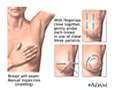 A breast self exam diagram.