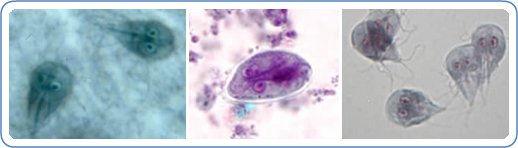 Left: G. intestinalis trophozoites in Kohn stain. Center: G. intestinalis cyst stained with trichrome. Right: G. intestinalis in in vitro culture, from a quality control slide.