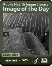  Public Health Image  Library Image of the Day Widget. Flash Player 9 is required.