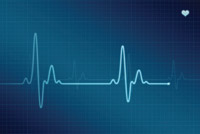 Results of an EKG on the monitor.