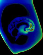 Thermal image of a brain