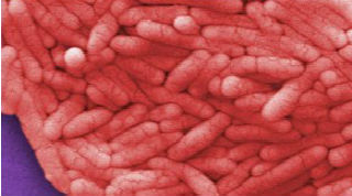 Salmonella typhi is a bacteria associated with some gallbladder cancers. Credit: CDC