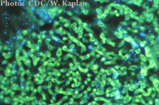 A photomicrograph of Aspergillus organisms