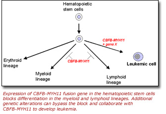 Diagram of the expression of CBFB-MYH11 fusion gene