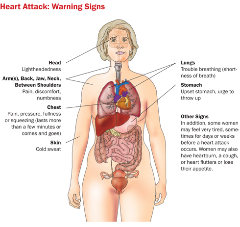 Warning signs of heart attack