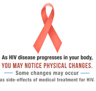 As HIV disease progresses in your body, you may notice physical changes. Some may occur as side-effects of medical treatment for HIV.