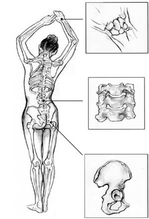 Ilustración de un cuerpo entero con tres imágenes detalladas de los huesos de la columna, las muñecas y la cadera.