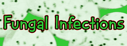 Fungal Infections