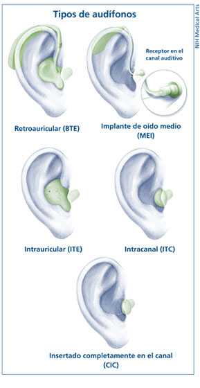 Tipos de audifonos